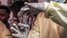 New form of mpox reported in US for 1st time