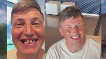 Arizona dental non-profit aims to give smiles back to people struggling with addiction